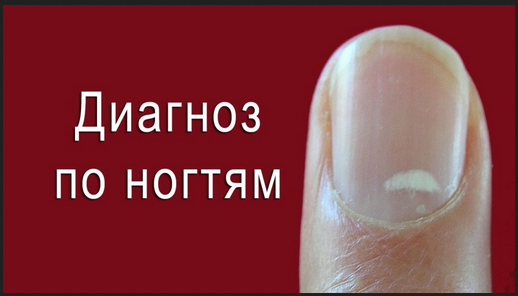 [Анна Шутова] Диагностика по ногтям (2021)_0.png